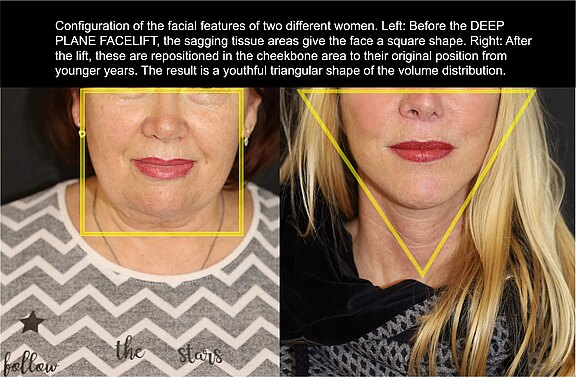 Configuration of facial features